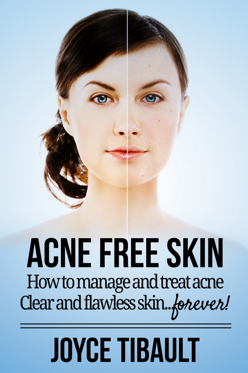 Acne Free Skin by Joyce Tibault